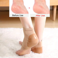 Heel Gel Shields (1 Pair) – Hydrating Cracked Heel Protectors for Daily Foot Care