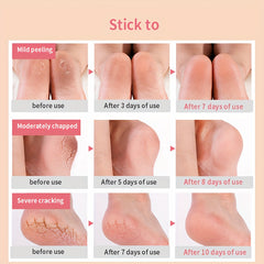 Heel Gel Shields (1 Pair) – Hydrating Cracked Heel Protectors for Daily Foot Care