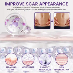 ReGenScar Stem Cell Scar Gel – Stretch Marks & Surgical Scars