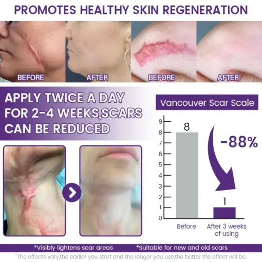 ReGenScar Stem Cell Scar Gel – Stretch Marks & Surgical Scars - alternate view