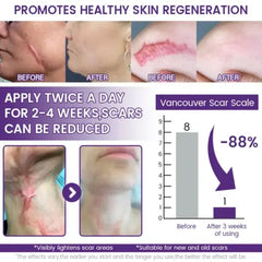 ReGenScar Stem Cell Scar Gel – Stretch Marks & Surgical Scars